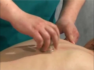 cupping massage